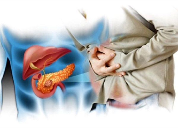 Triệu chứng viêm tụy mạn tính có thể gây nên cơn đau từ vùng thượng vị rồi lan ra sau lưng