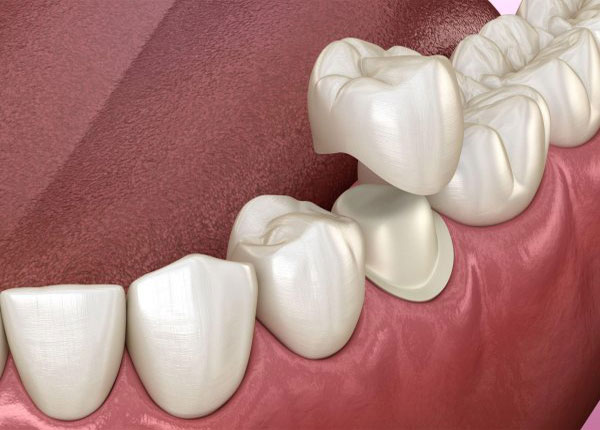 Trung cấp Kỹ thuật Phục hình Răng