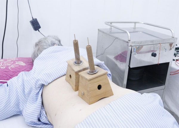 Kỹ thuật điều trị không dùng thuốc