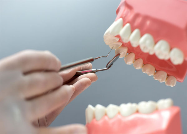 kỹ thuật phục hình răng